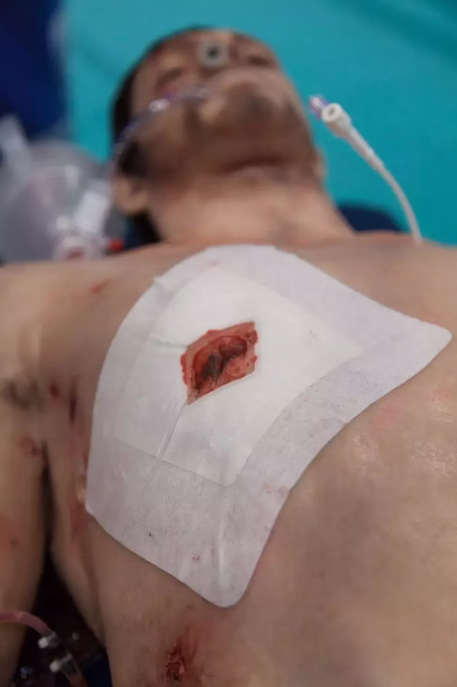 Russell Chest Seal Okklusivverband