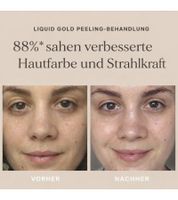 ALPHA-H Liquid Gold Peeling-Behandlung mit ca. 5% Glykolsäure Kosmetik Hautpflege strahlender Teint natürliche Hauterneuerung Hautstraffung 50ml