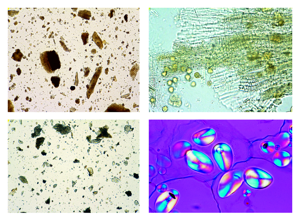 Drug Powders, 25 microscope slides | PHYWE